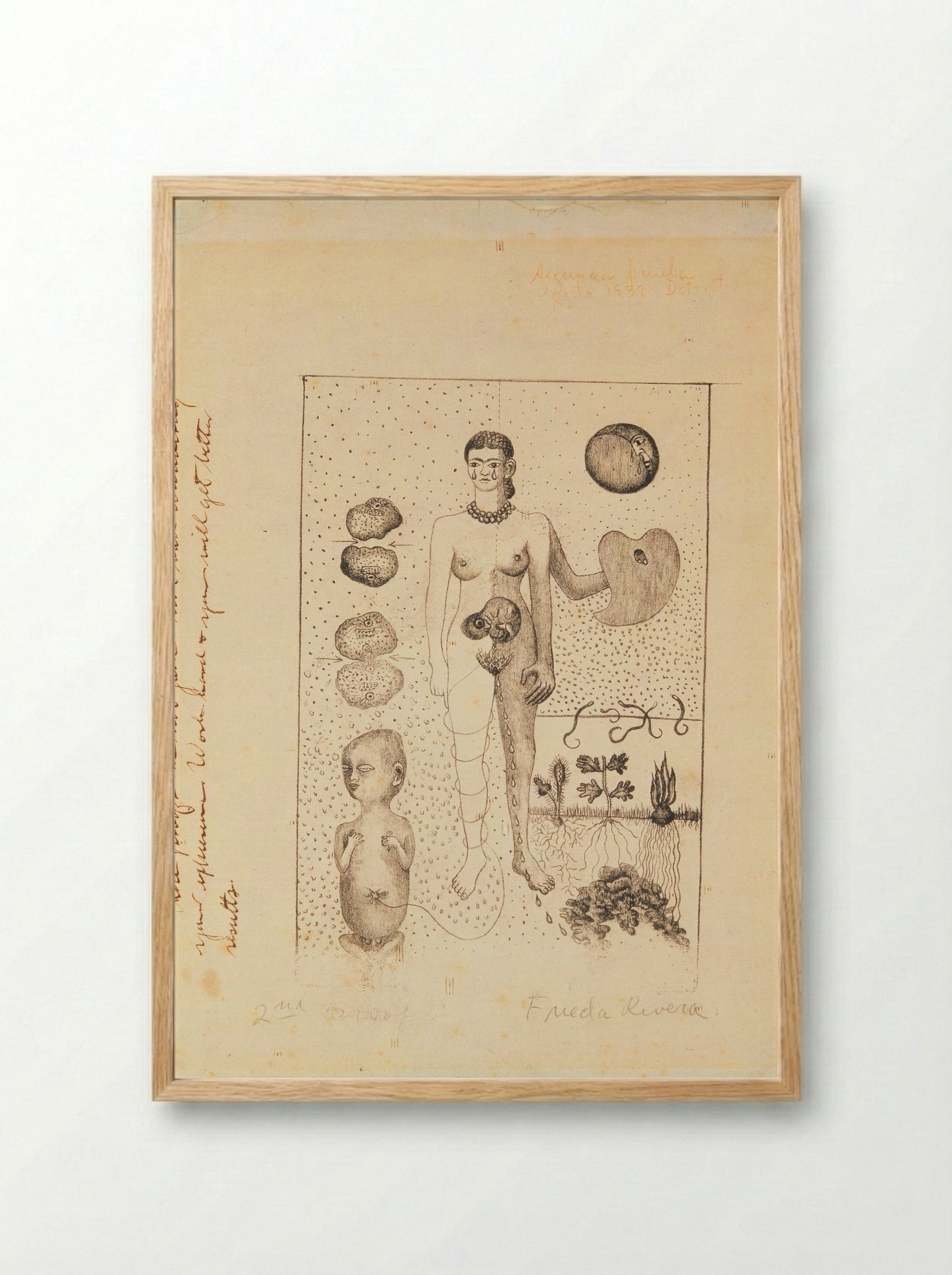 Untitled (Frida and the Miscarriage) - Frida Kahlo - Framed Print Wood