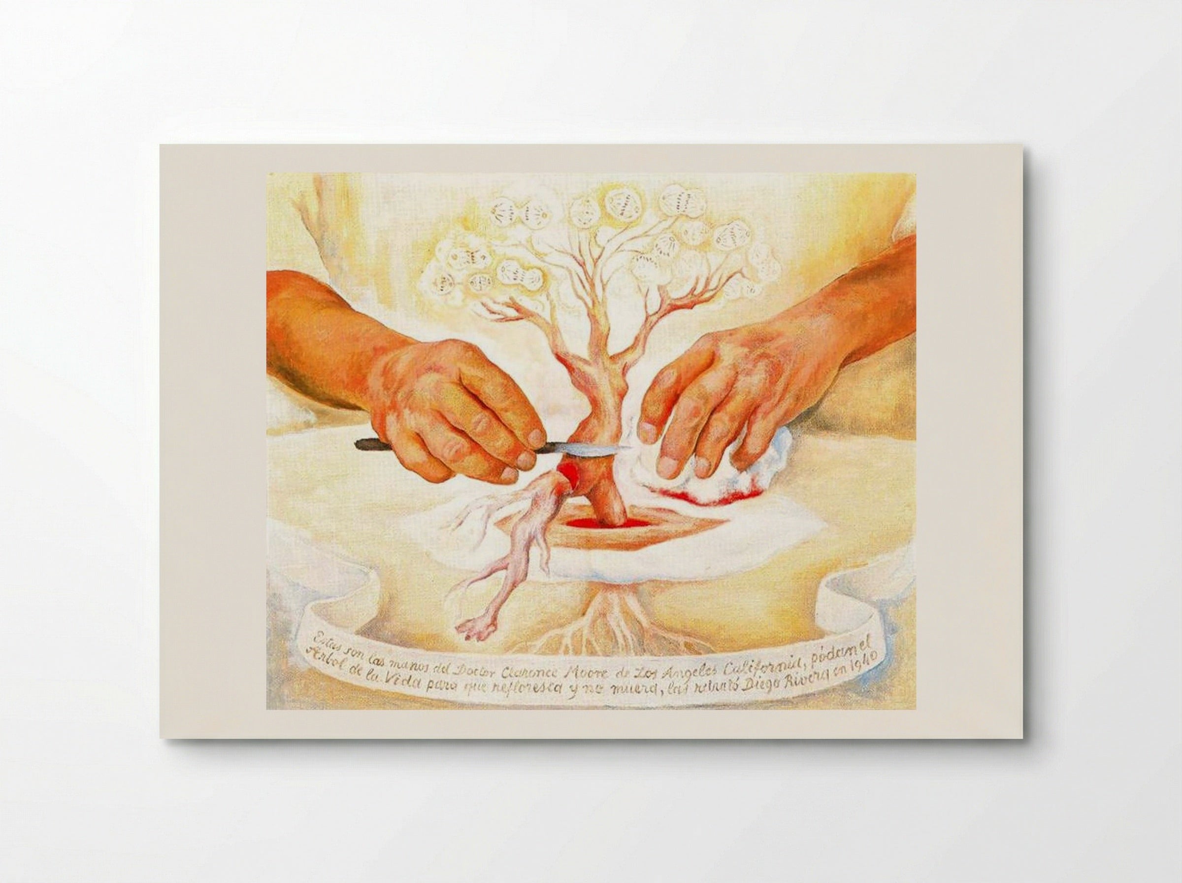 The Hands of Dr. Moore - Diego Rivera - Poster