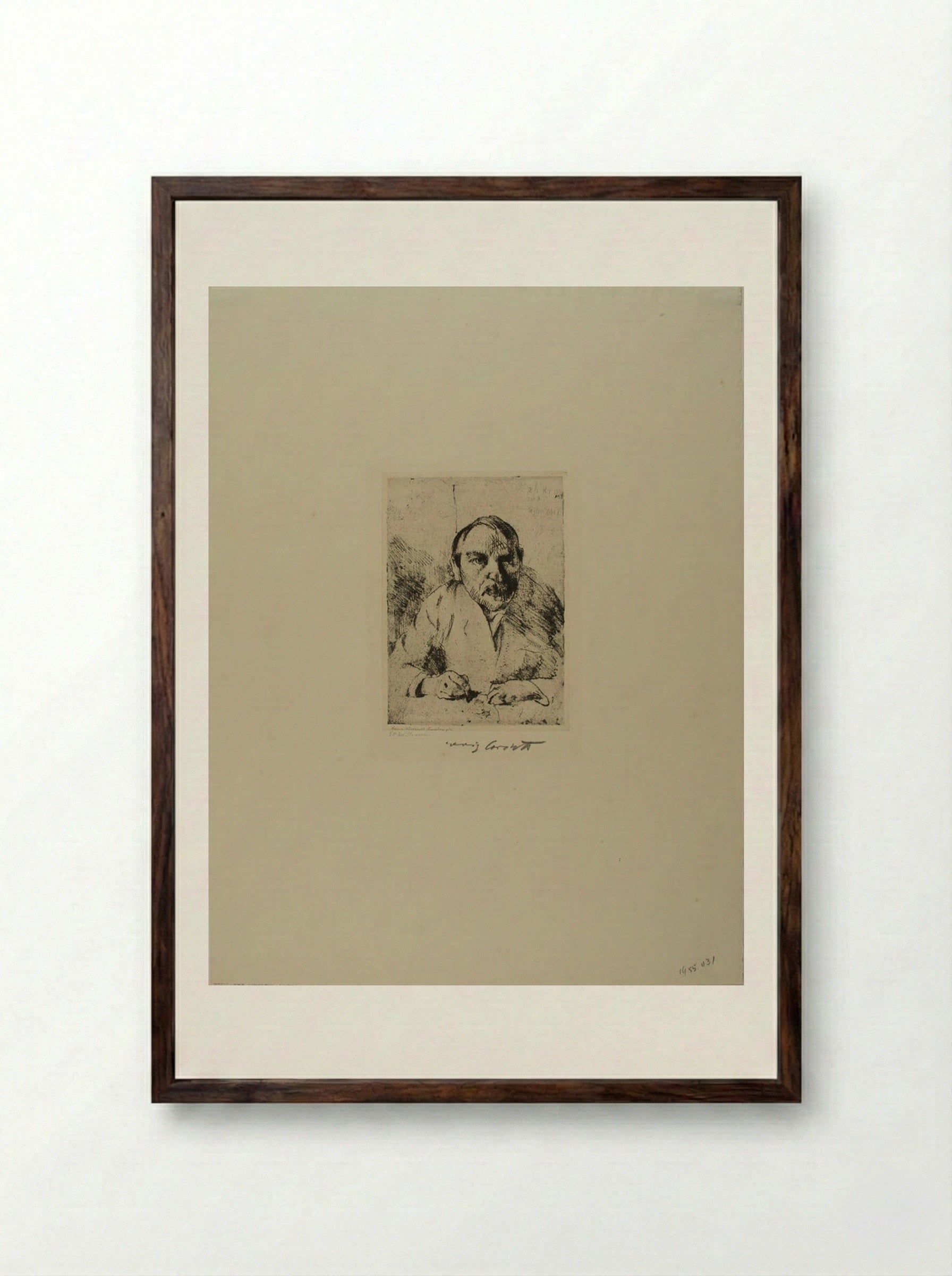 Self-Portrait after an Illness - Lovis Corinth - Framed Print Dark Wood