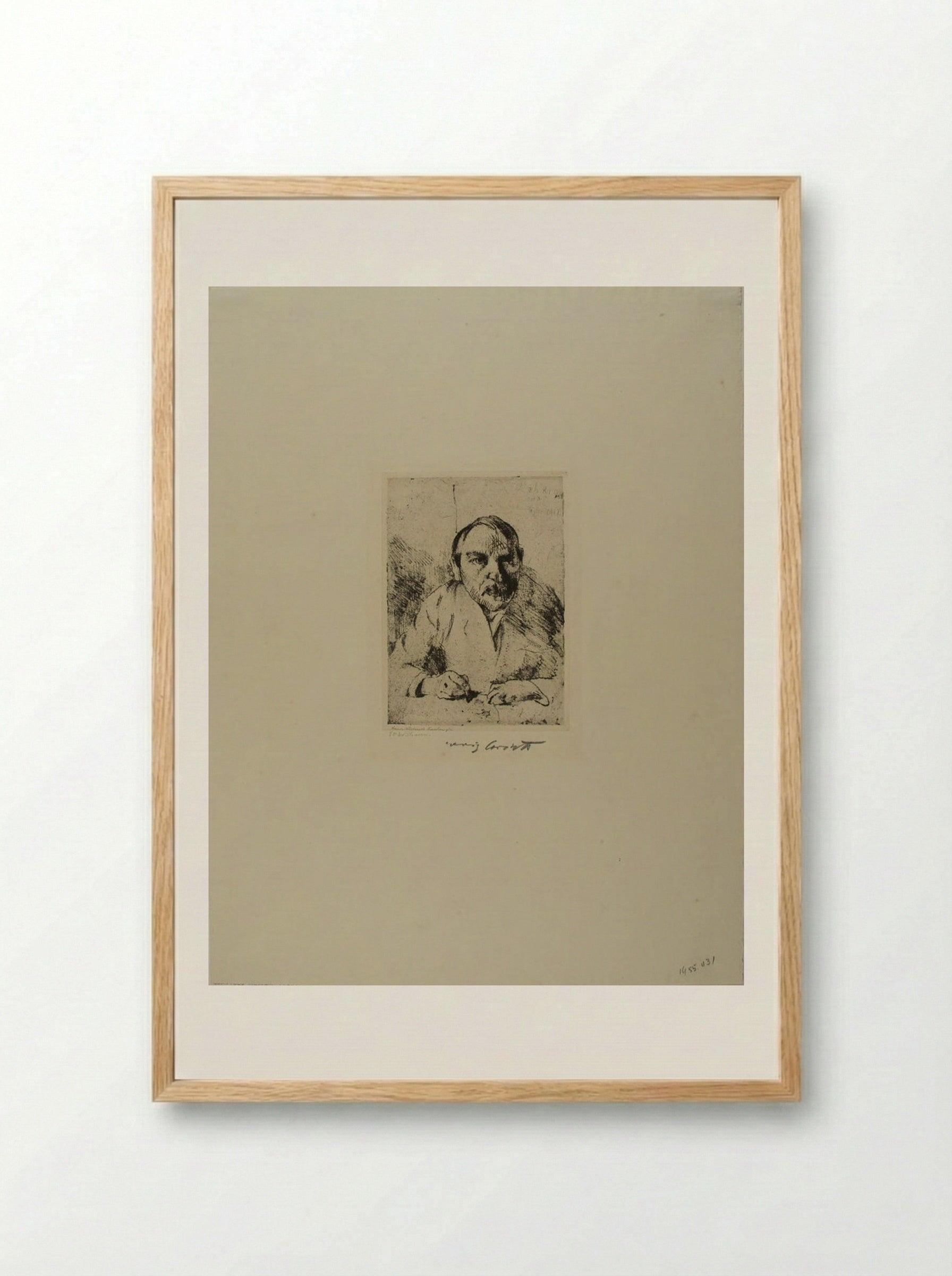 Self-Portrait after an Illness - Lovis Corinth - Framed Print Wood