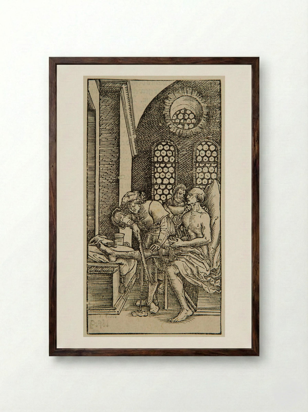 Surgeon Cutting off a Man's Leg - Hans Weiditz - Framed Print Dark Wood