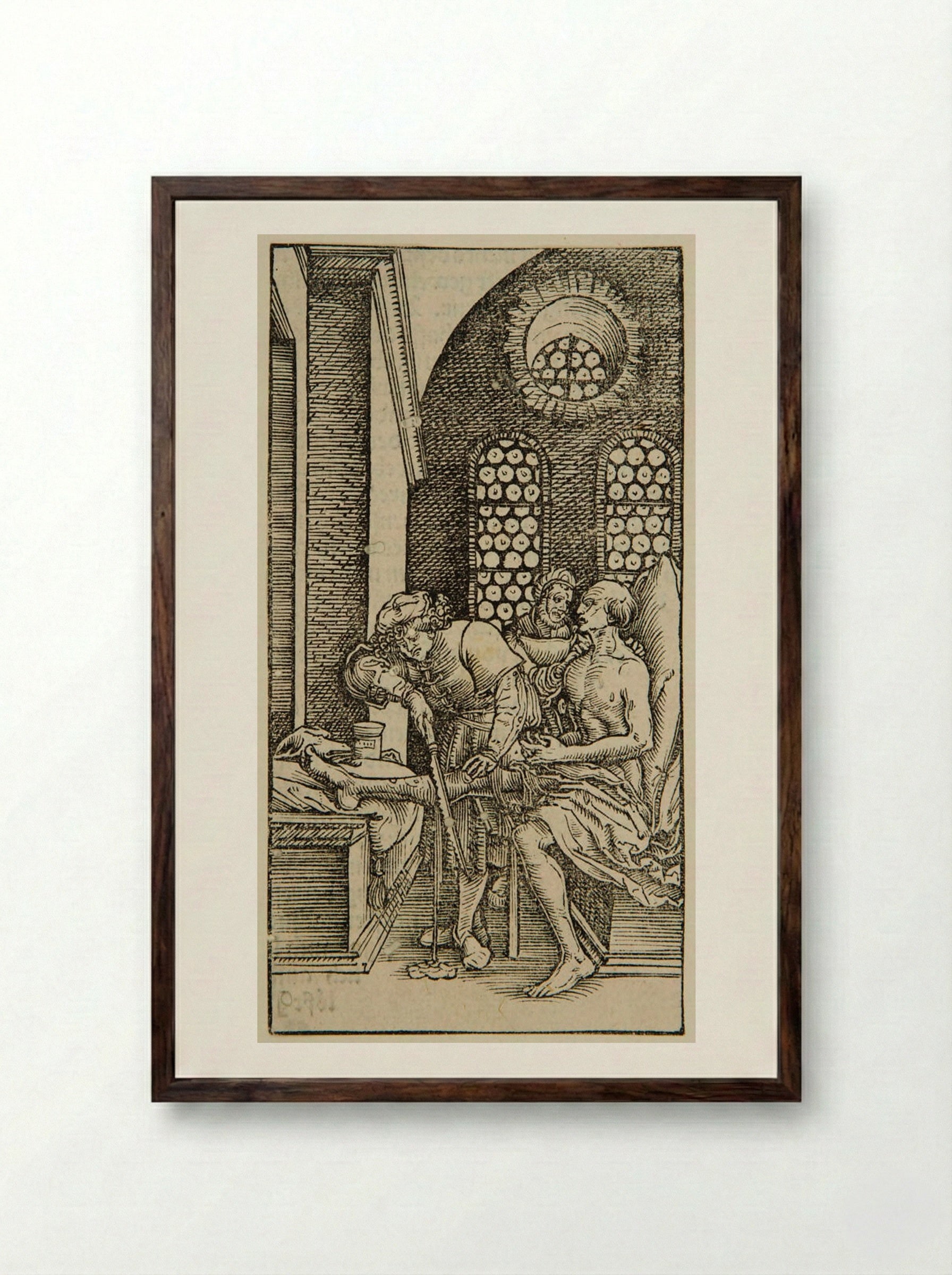 Surgeon Cutting off a Man's Leg - Hans Weiditz - Framed Print Dark Wood