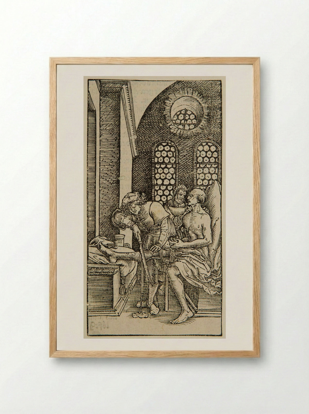 Surgeon Cutting off a Man's Leg - Hans Weiditz - Framed Print Wood