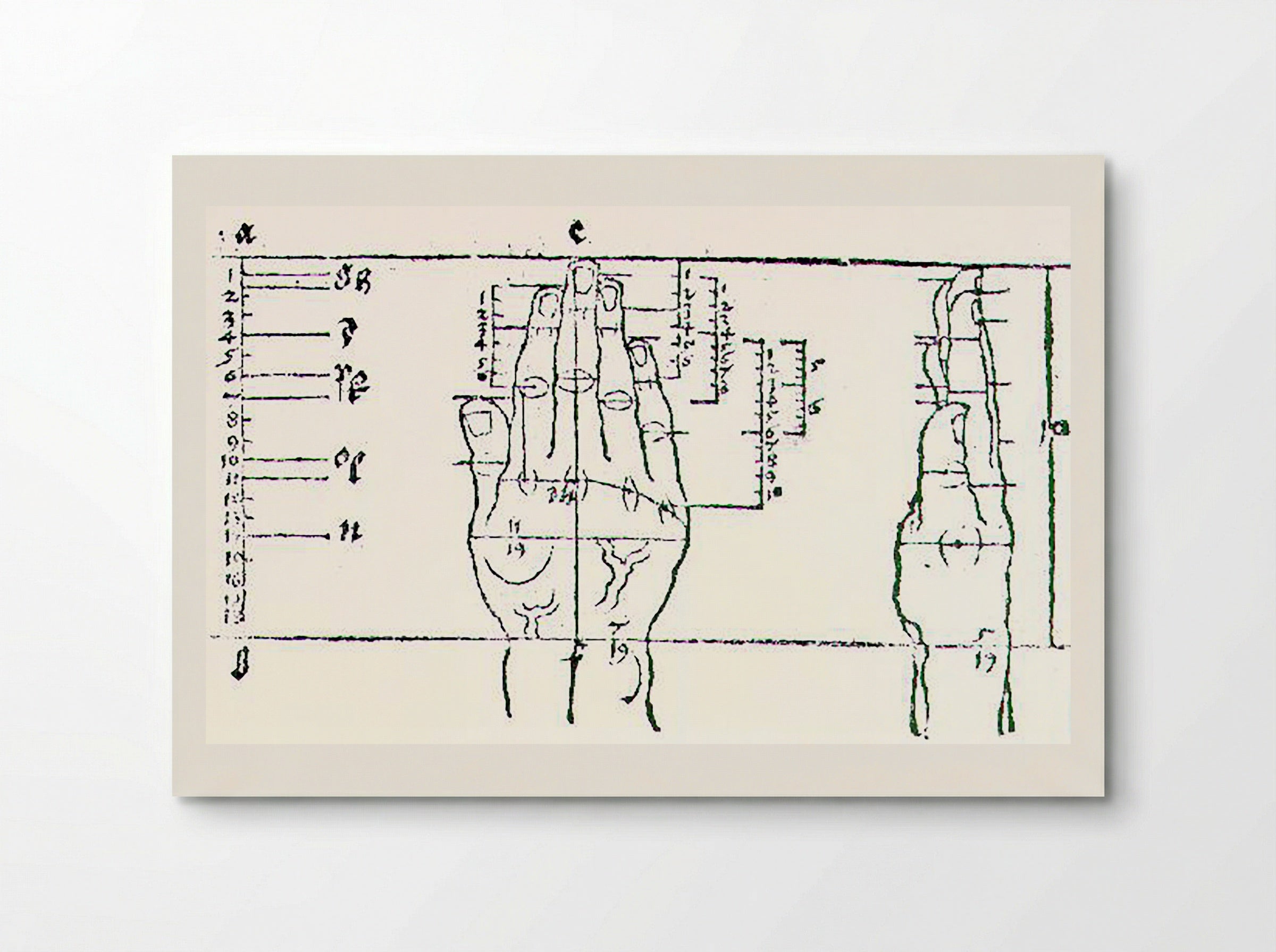 Untitled (Anatomical Study of a Hand) - Fine Art Print - Poster