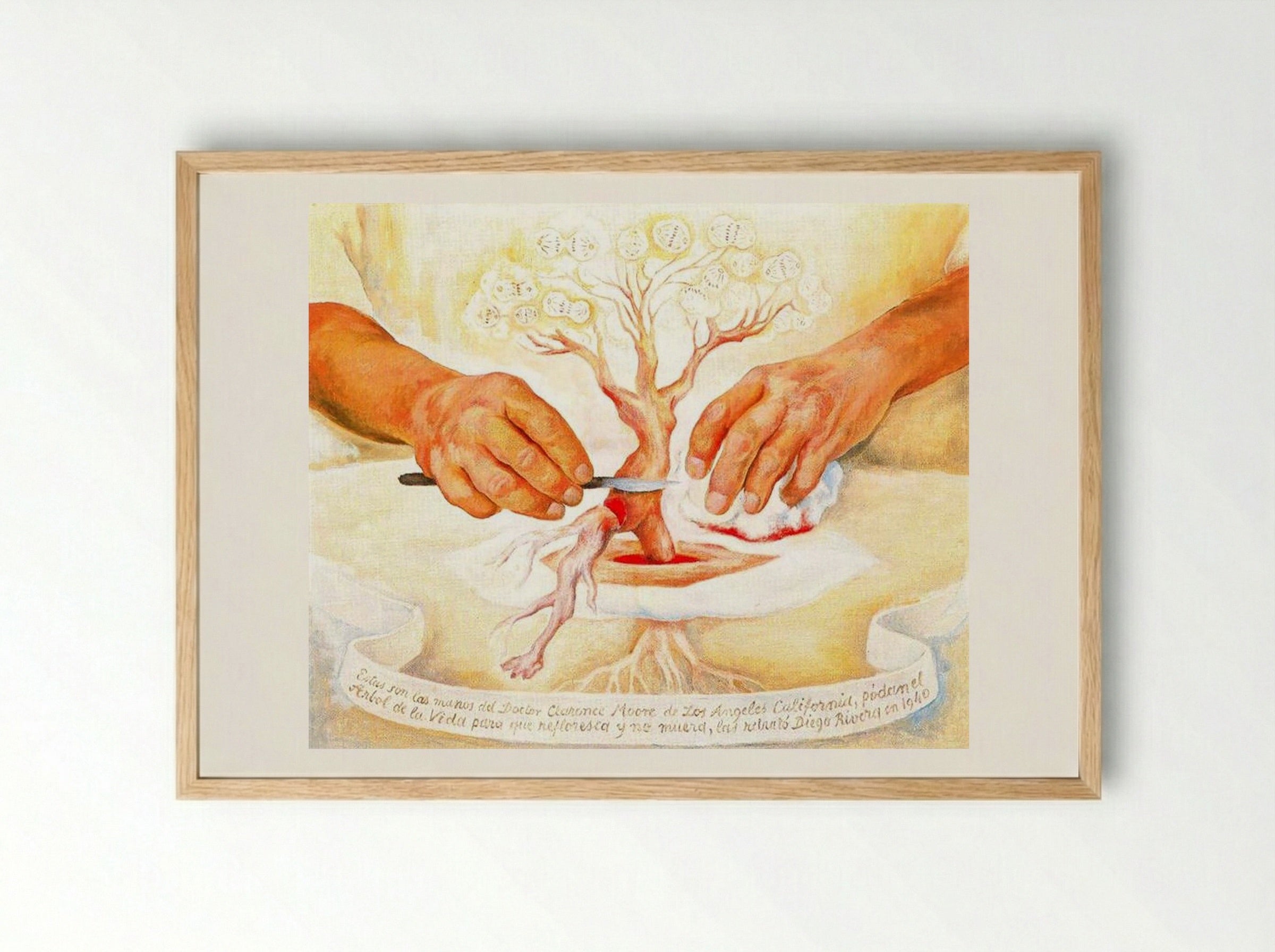 The Hands of Dr. Moore - Diego Rivera - Framed Print Wood
