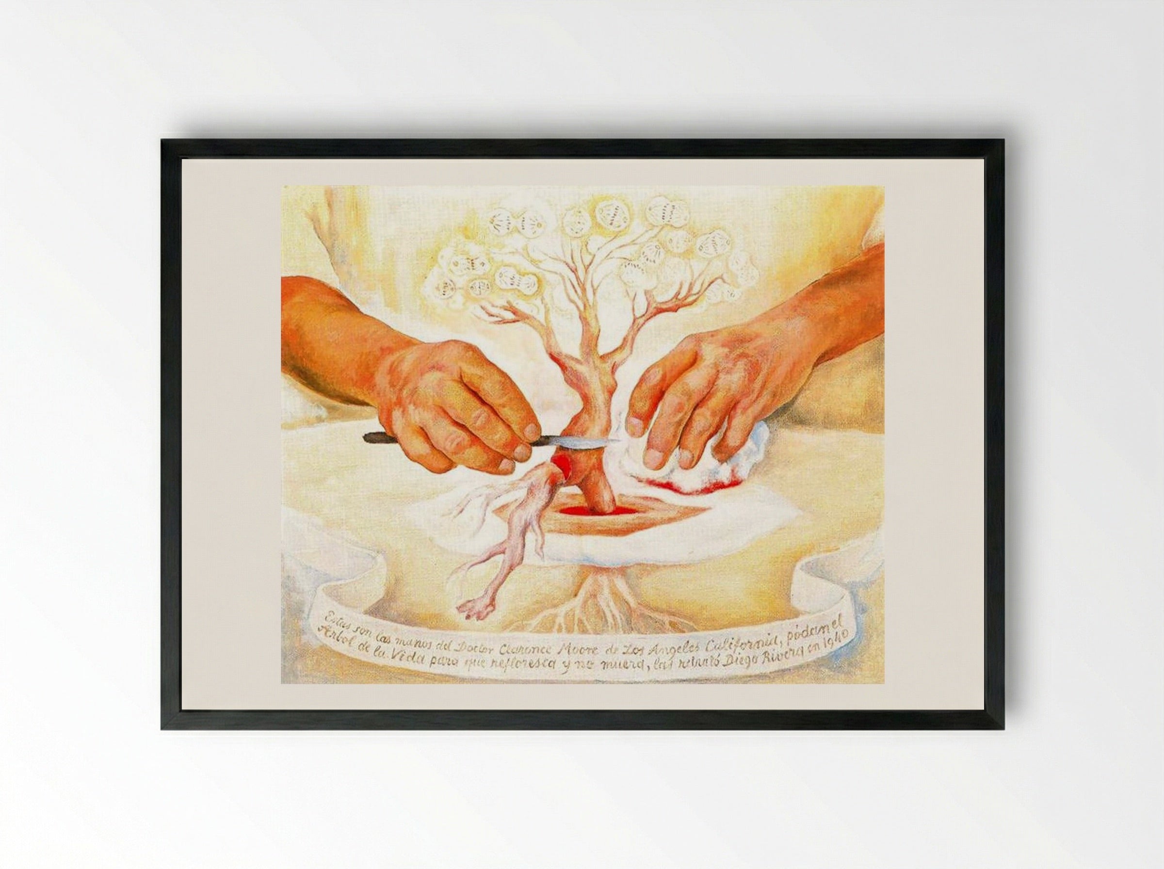 The Hands of Dr. Moore - Diego Rivera - Framed Print Black