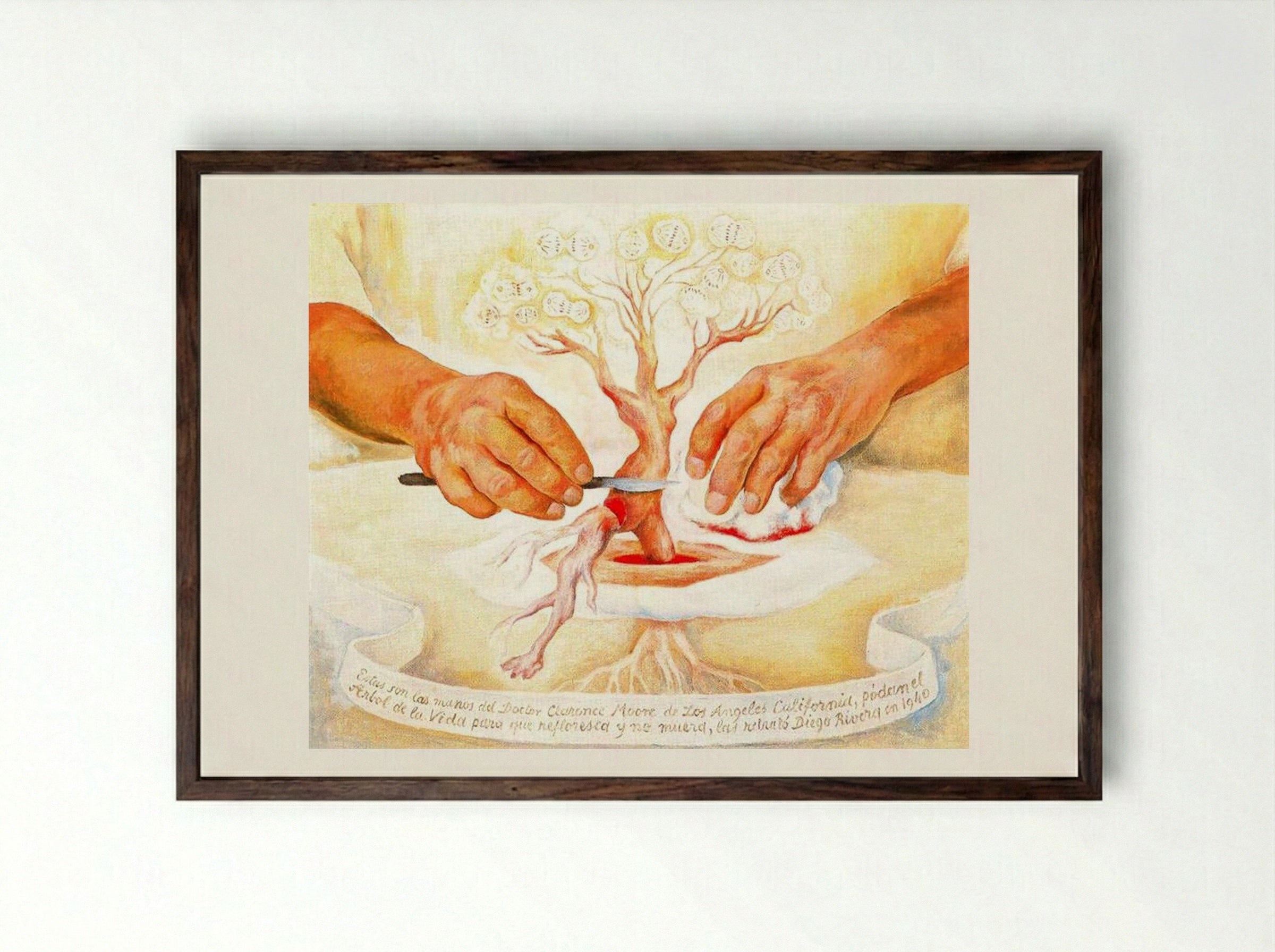 The Hands of Dr. Moore - Diego Rivera - Framed Print Dark Wood