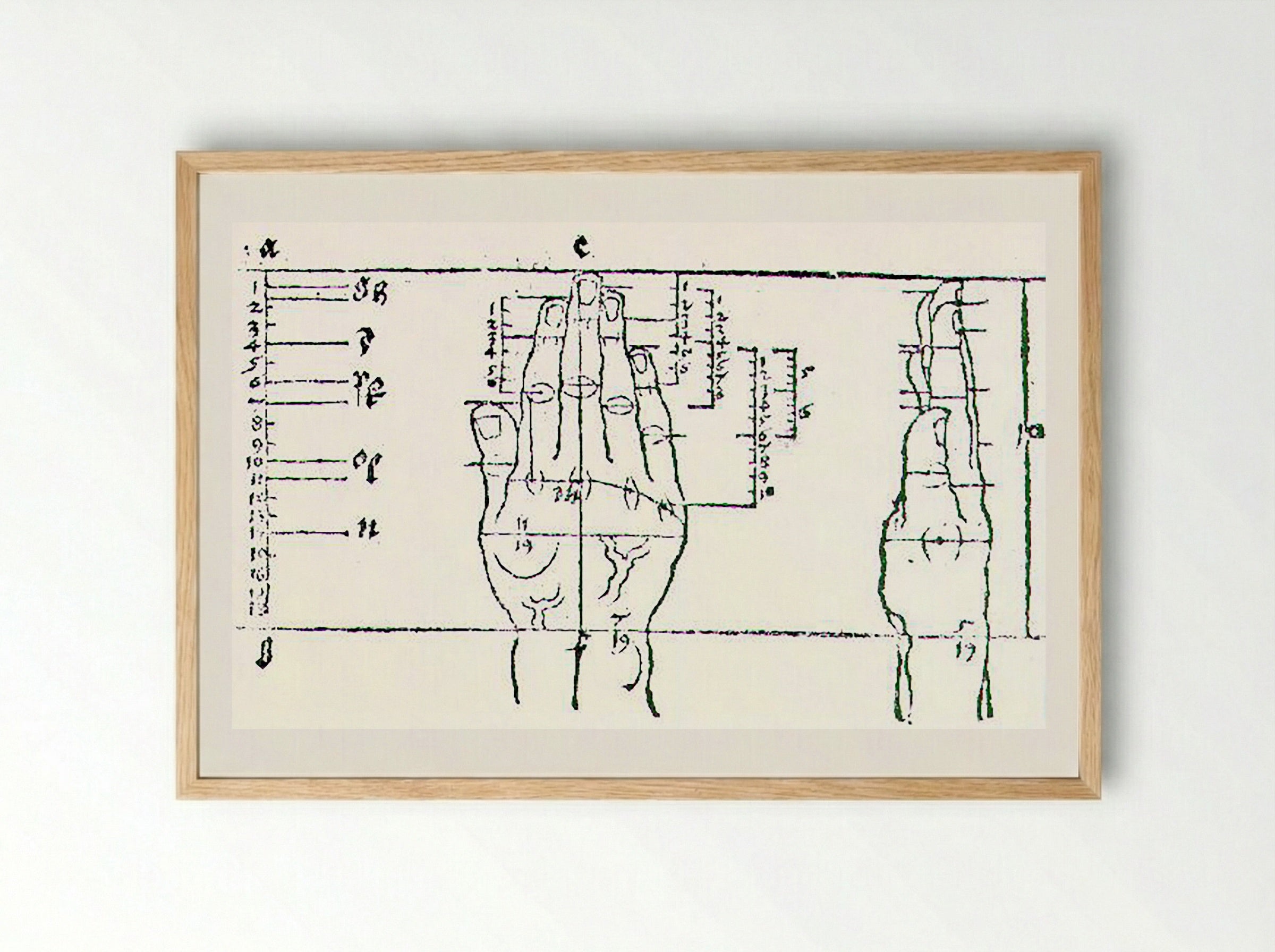Untitled (Anatomical Study of a Hand) - Fine Art Print - Framed Print Wood